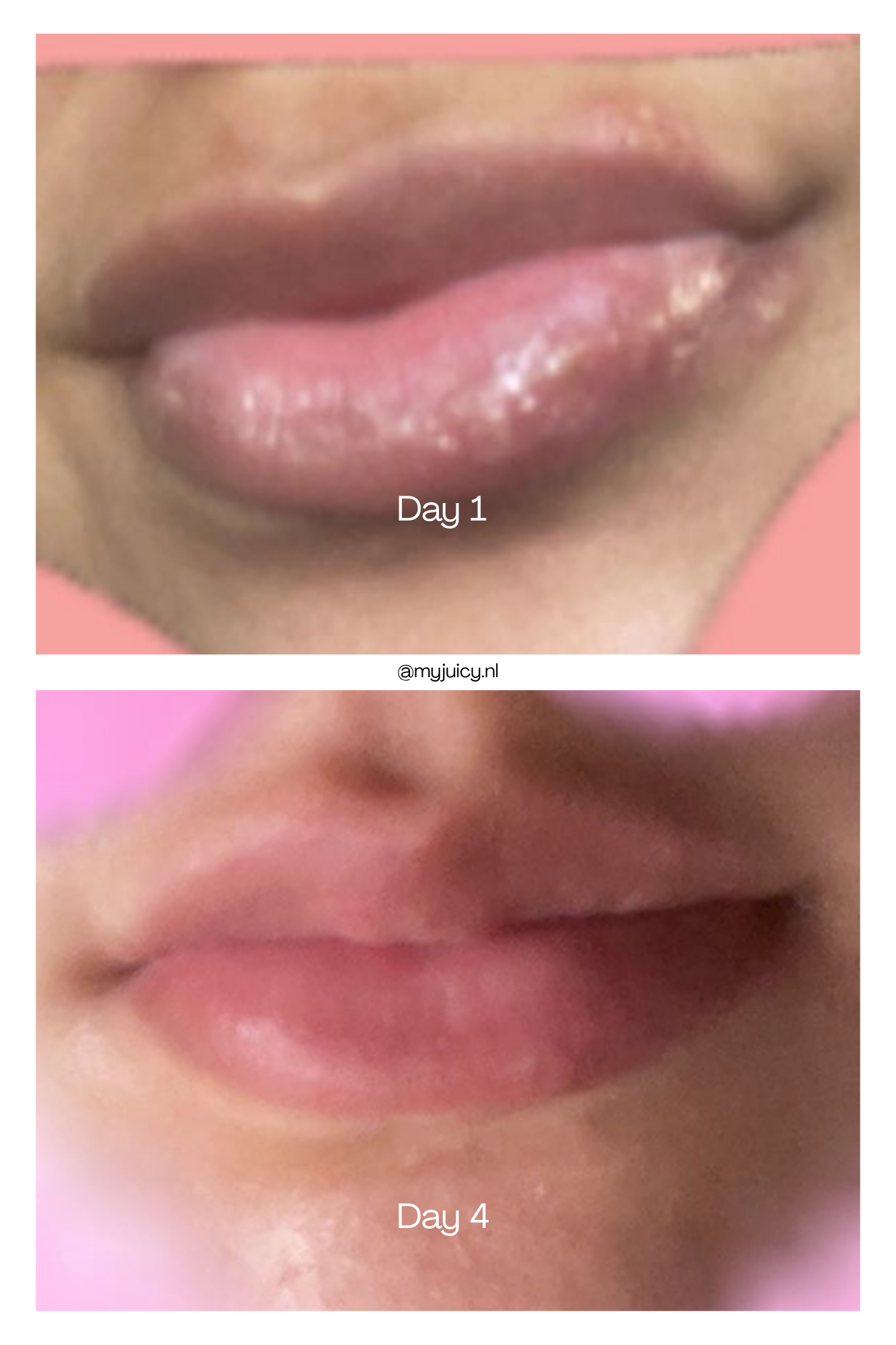 !PRE-ORDER! DEEP LIP TREATMENT - CLEAR